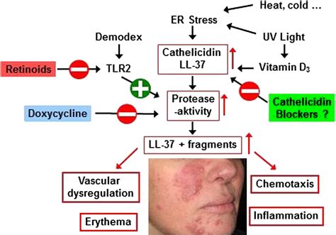 Rosacea Treatment Pathway.